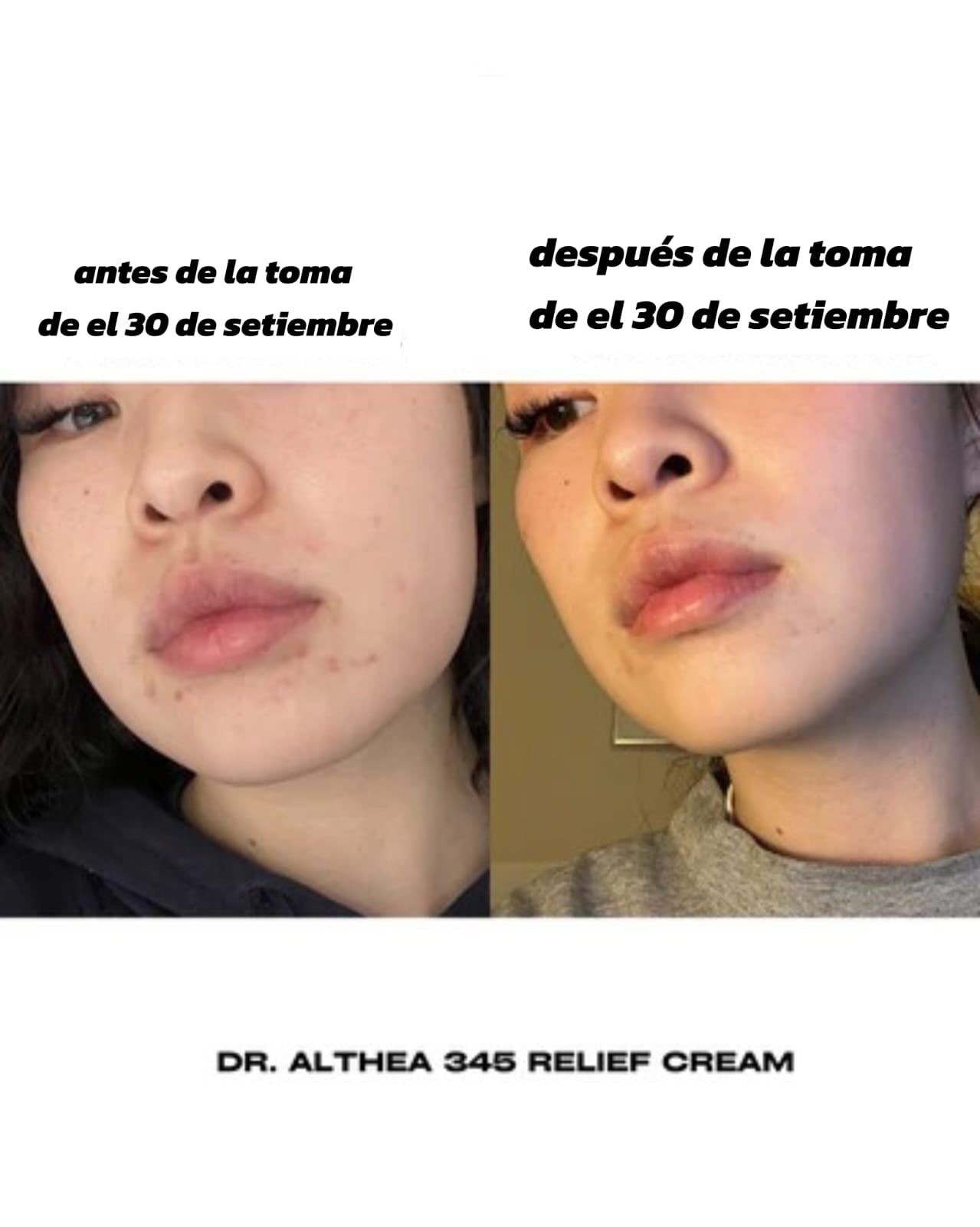 🌸 Dr. Althea 345  – 50ml 💎