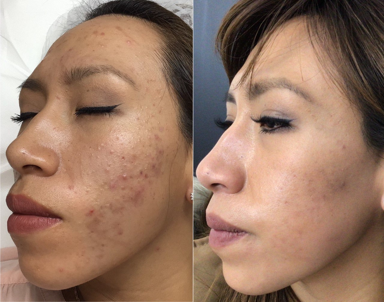 RETINOL 2.0 🌸